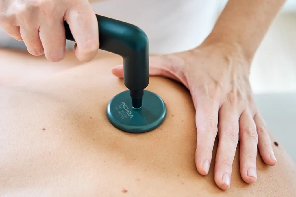 Tratamiento INDIBA en fisioterapia, Aluche Madrid